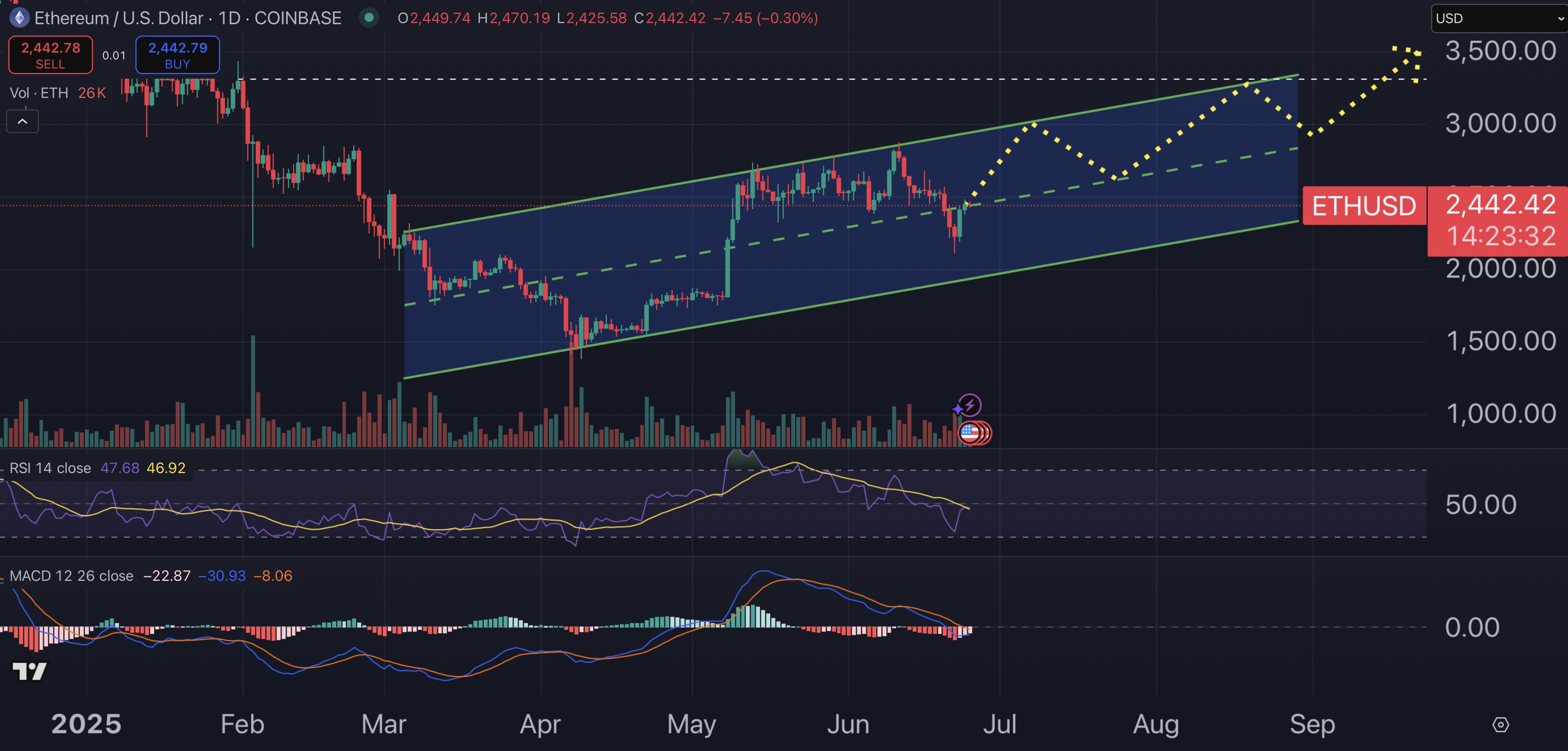 Ethereum Price Forecast: Major Investor Acquires $422M in ETH — Significant Developments Ahead?0